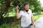Khao Sod photojournalist Madaree Tohlala suffered significant shrapnel wounds after a bomb exploded near him in Narathiwat on October 19th. Despite his injury, Madaree continued to take pictures to document the attacks by insurgents in the Deep South [Khabar]