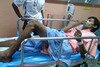  Seorang korban bom, Ayub Aseh, sedang dirawat di Rumah Sakit Srisakhon di Narathiwat. Ayub terluka dan terlempar ke belakang akibat daya ledak bom rakitan (IED) pinggir jalan di dekat Desa Dahong. Penduduk setempat datang membantunya. [Rapee Mama/Khabar] 